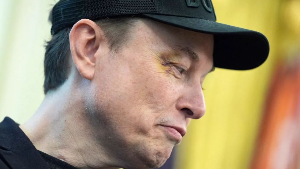 Elon Musk gözündeki morluğun nedenini açıkladı: 'Suratıma yumruk at'