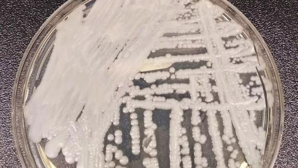 Uzmanlar uyarıyor: 'Dirençli mantarlar yeni bir pandemi yaratabilir'