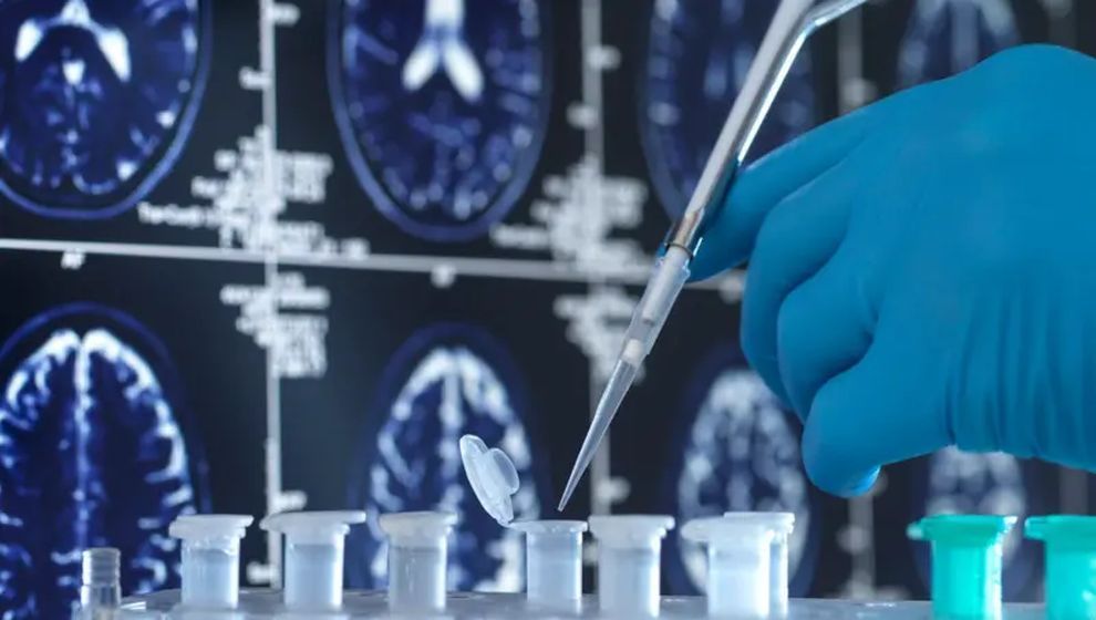Alzheimer'a virüsler mi yol açıyor?