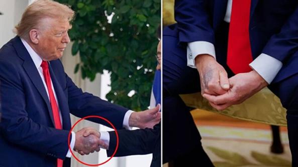 Trump'ın eli yine gündemde, Beyaz Saray'dan açıklama geldi