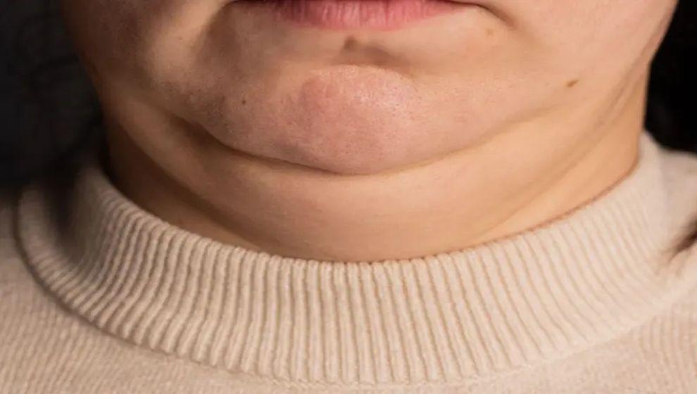 Boyun kalınlığımız sağlığımız hakkında ne söylüyor olabilir?