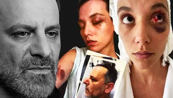 Sinema oyuncusu Ozan Güven, eski sevgilisi Deniz Bulutsuz'u dövmekten 45 gün hapis yatacak