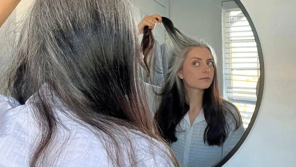 Saçın erken beyazlamasının nedenleri neler, eski saçları geri getirmek mümkün mü?