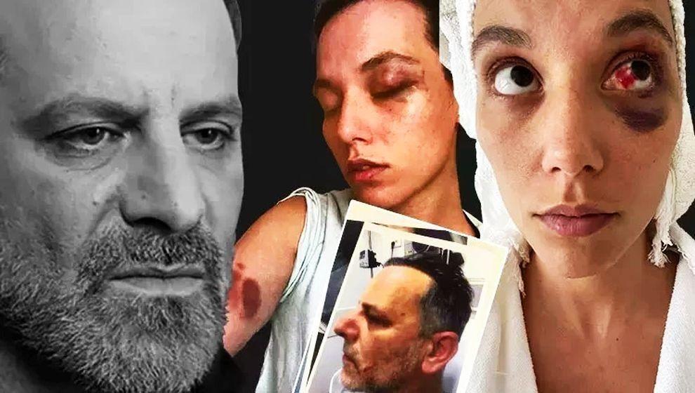 Sinema oyuncusu Ozan Güven, eski sevgilisi Deniz Bulutsuz'u dövmekten 45 gün hapis yatacak