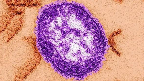 ABD'de yüzlerce kişi kızamık salgınında karantinaya alındı