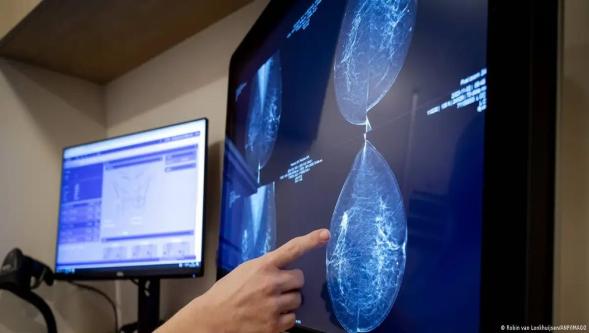 Yapay zeka meme kanserini 5 yıl önceden tahmin ediyor