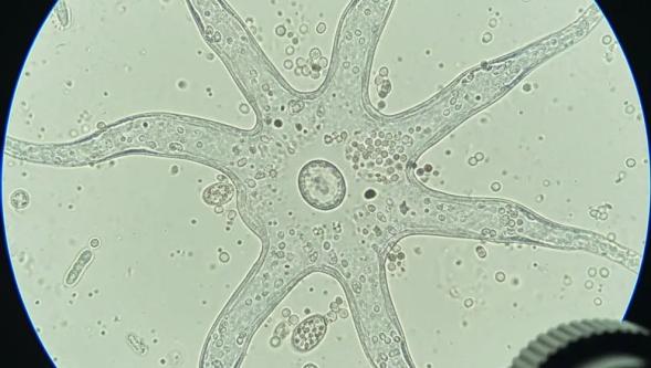 Bilim insanlarından amip uyarısı: 'Dünya genelinde su sistemlerine yayılıyor'