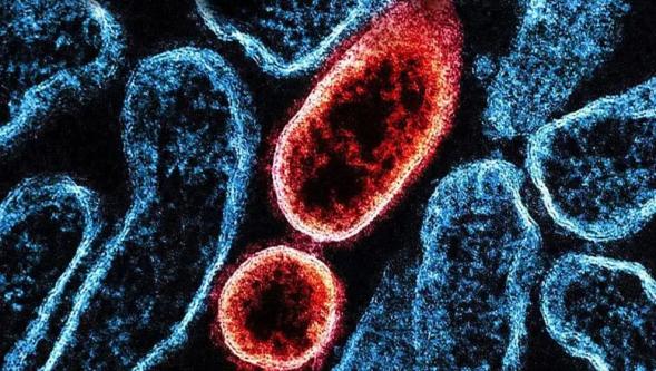 Nipah virüsü paniği: Dünya yeni bir salgının eşiğinde mi?